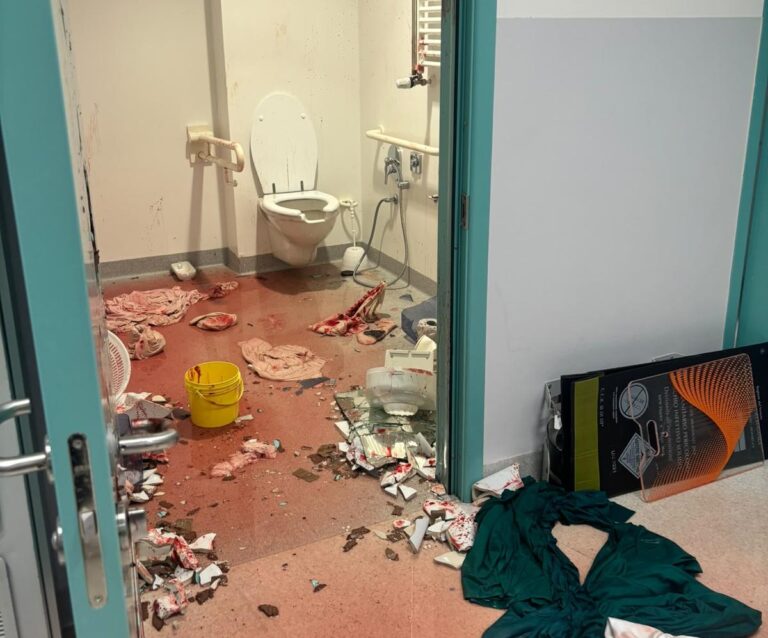 Paziente danneggia l’area rossa del Pronto soccorso degli ospedali riuniti di Padova sud: “Episodio molto grave”